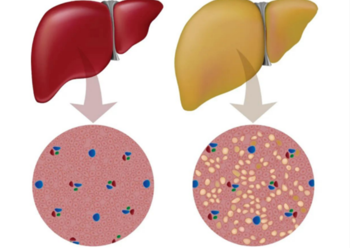 Bioglutide NA-931 Cost | Shaanxi BLOOM Tech Co., Ltd Bioglutide NA-931 Cost | Shaanxi BLOOM Tech Co., Ltd